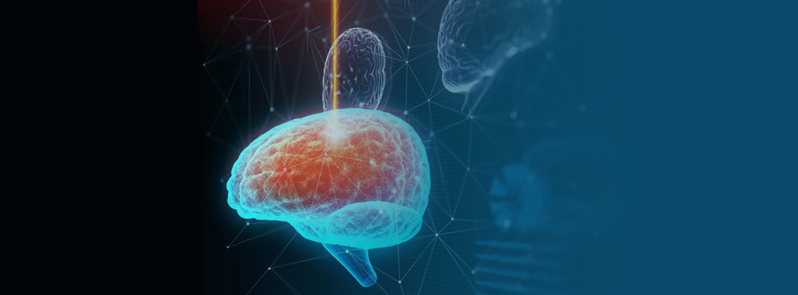 srs ακτινοχειρουργικη